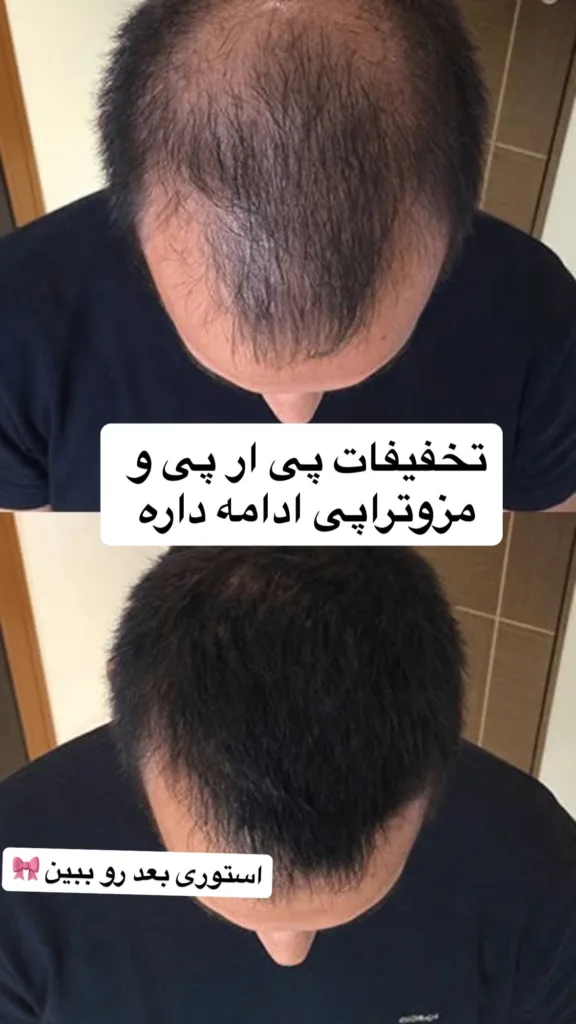 نمونه پی آر پی کلینیک زیبایی نویان اراک