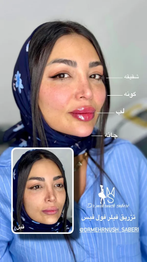 نمونه فول فیس کلینیک زیبایی دکتر مهرنوش صابری بندرعباس