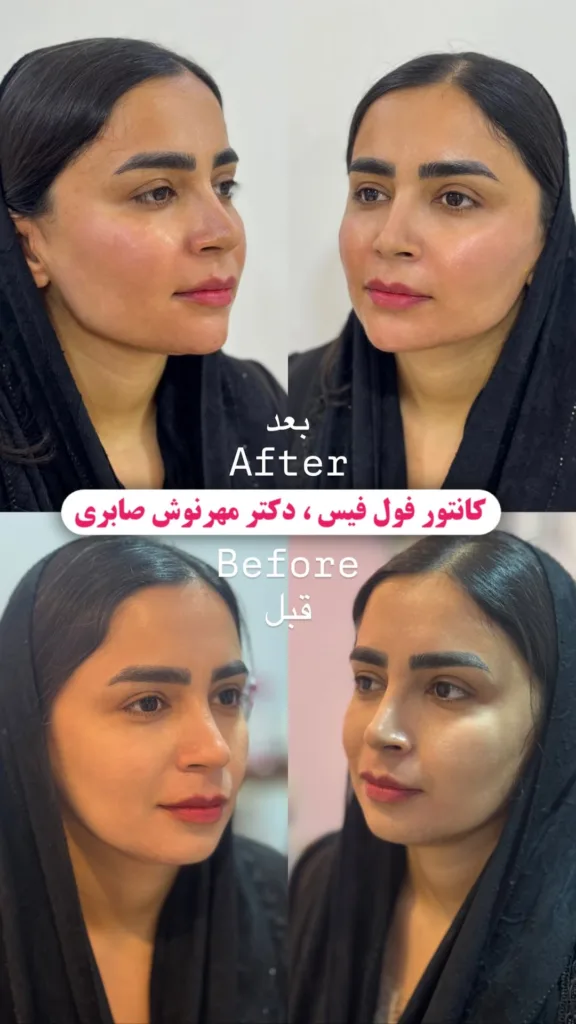 نمونه فول فیس کلینیک زیبایی دکتر مهرنوش صابری بندرعباس