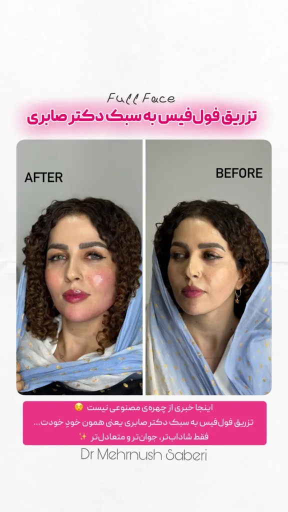 نمونه فول فیس کلینیک زیبایی دکتر مهرنوش صابری بندرعباس