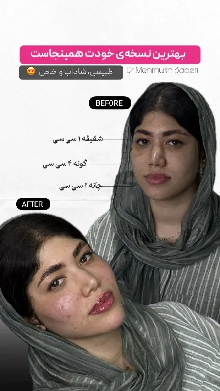 نمونه کانتورینگ کلینیک زیبایی دکتر مهرنوش صابری بندرعباس