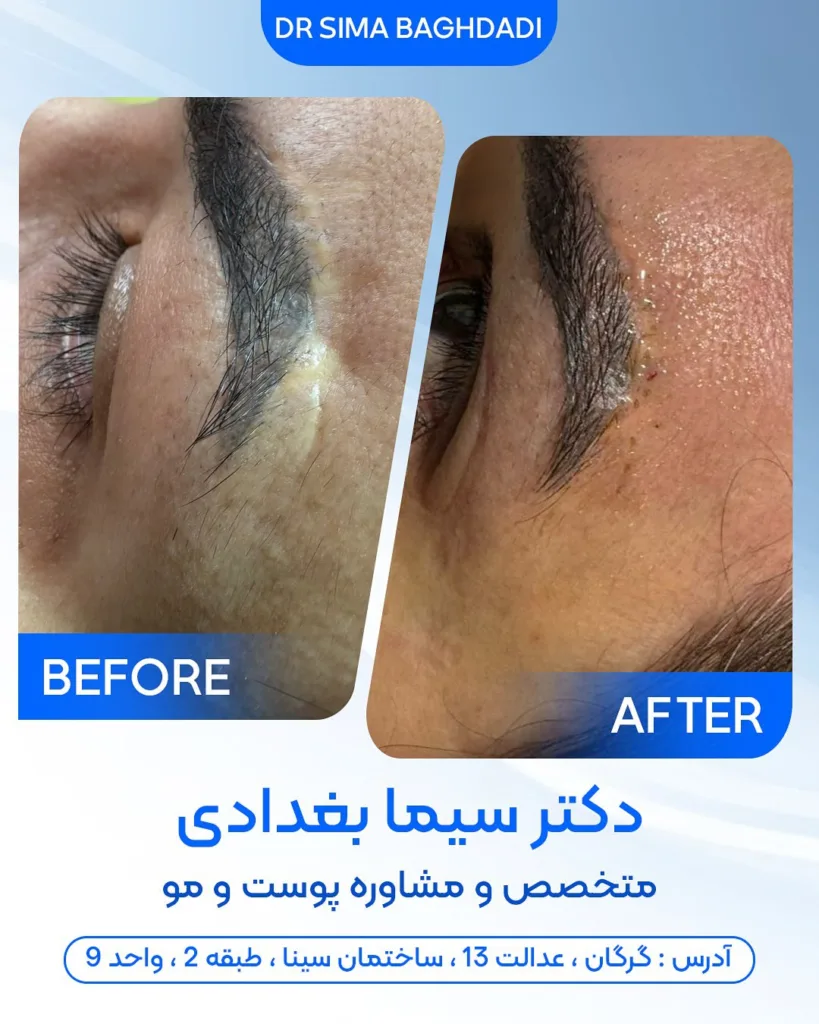 نمونه کار کلینیک تخصصی پوست و موی به سیما گرگان