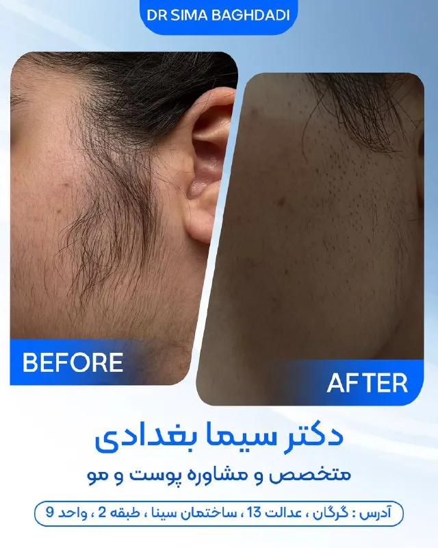 نمونه کار کلینیک تخصصی پوست و موی به سیما گرگان