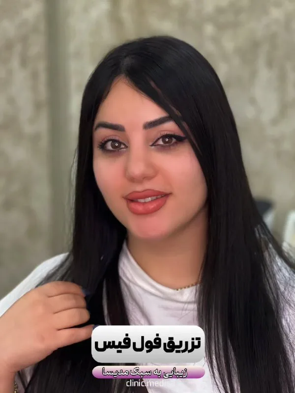 نمونه کار کلینیک زیبایی دکتر سارا سعیدی یاسوج