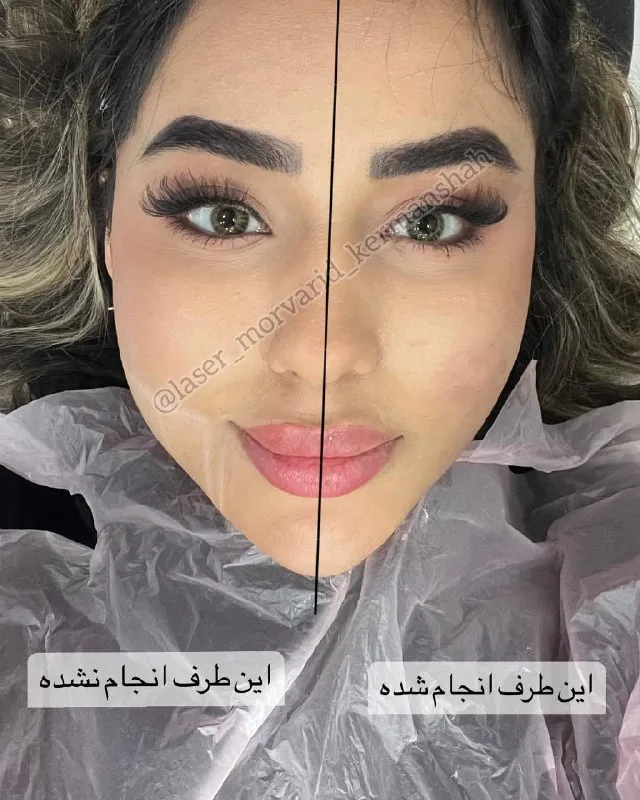نمونه کار مرکز لیزر و زیبایی مروارید کرمانشاه