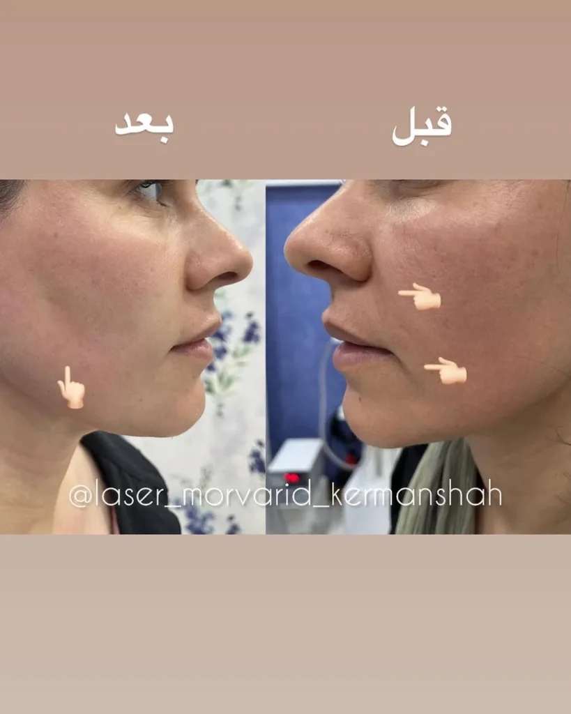 نمونه کار مرکز لیزر و زیبایی مروارید کرمانشاه