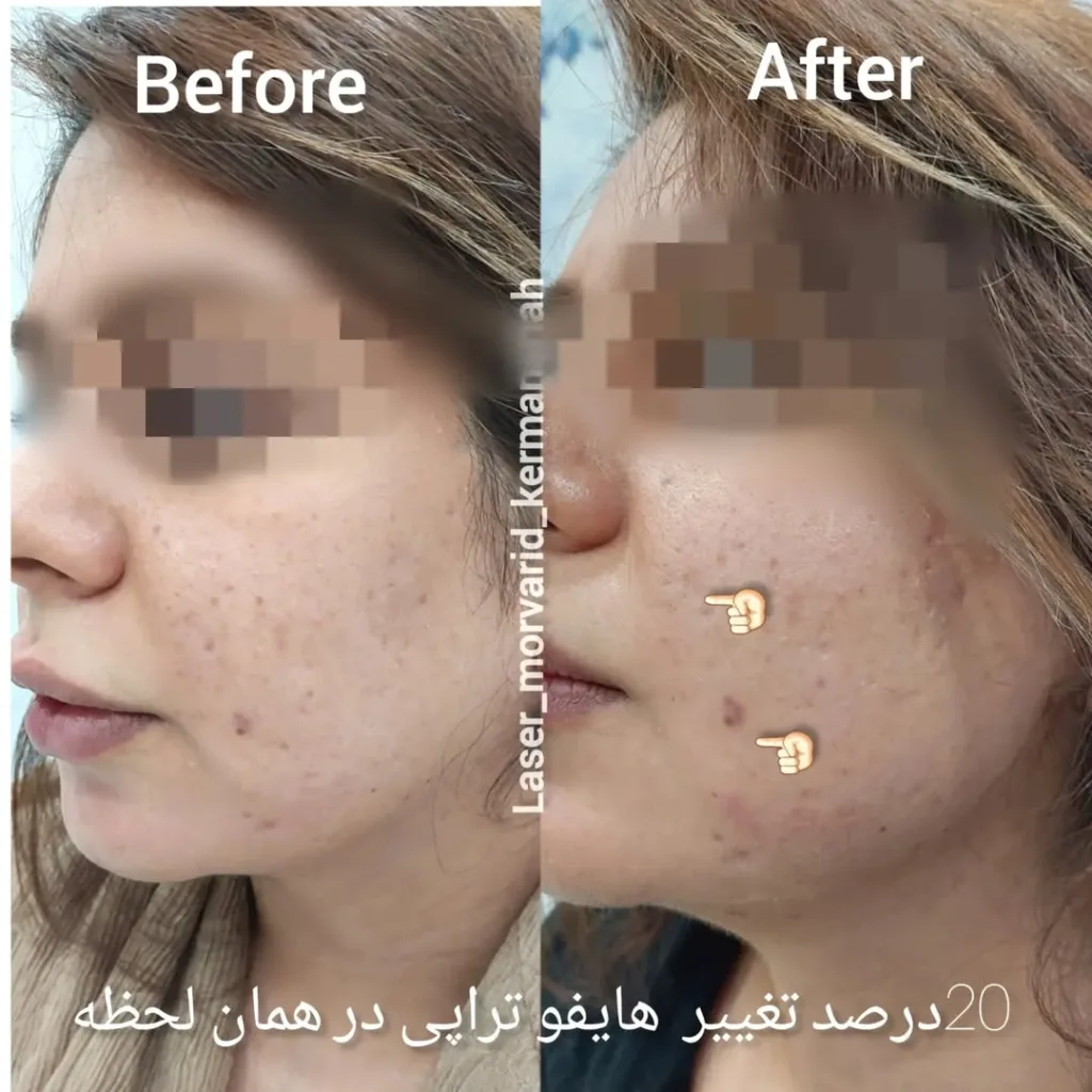 نمونه کار مرکز لیزر و زیبایی مروارید کرمانشاه