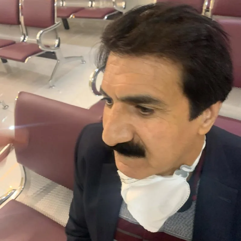 نمونه کاشت کلینیک زیبایی دکتر فاطمه احمدآقایی کرمانشاه