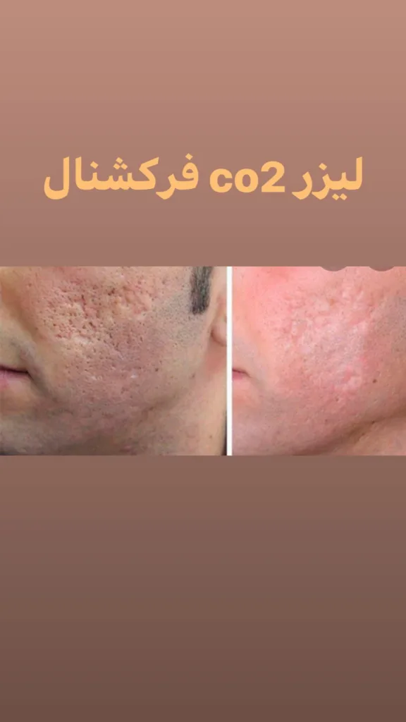 نمونه لیزر مطب دکتر ساسان فرحناکی کرمانشاه