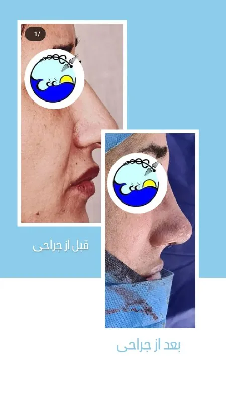 نمونه کار نمونه کار کلینیک زیبایی دکتر رامک ممتاز کرمانشاه