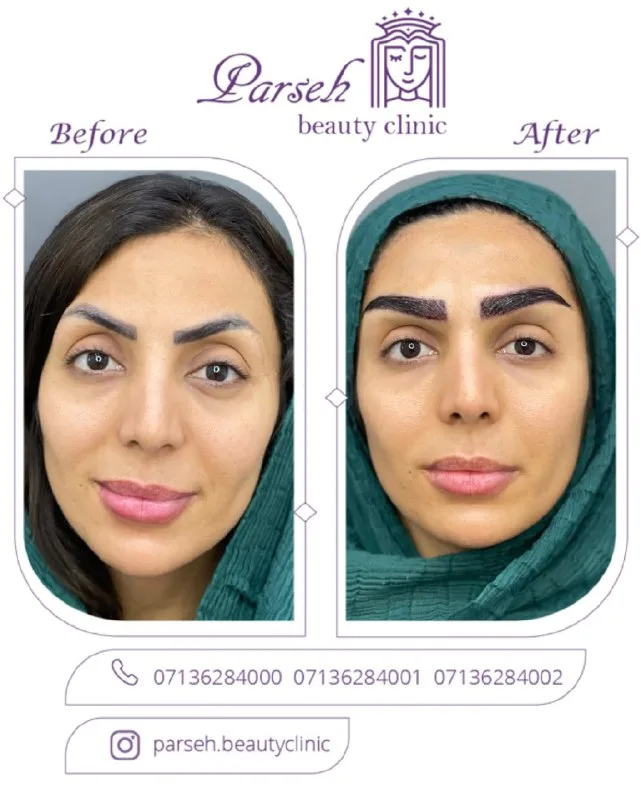 نمونه کار کلینیک پوست و زیبایی پارسه شیراز