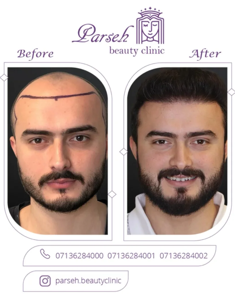 نمونه کار کلینیک پوست و زیبایی پارسه شیراز