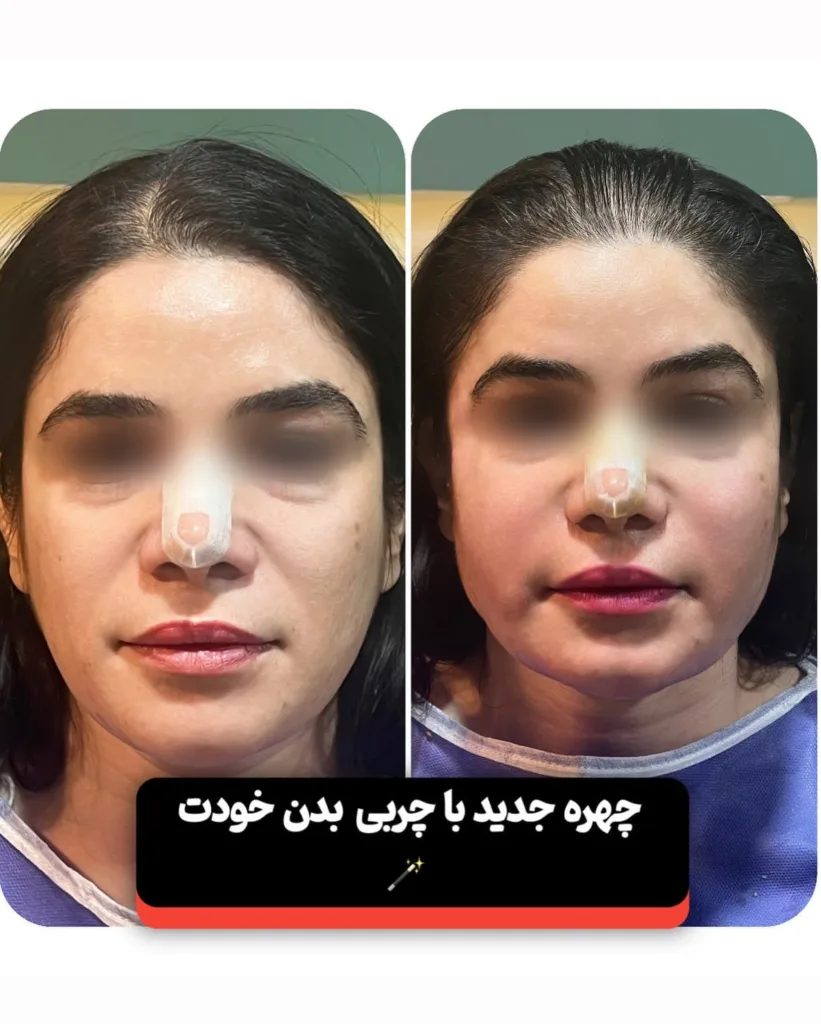 نمونه کار کلینیک زیبایی دکتر پوریا رمضانی شیراز