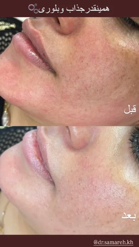 نمونه کار مرکز لیزر و زیبایی آفتاب زاهدان