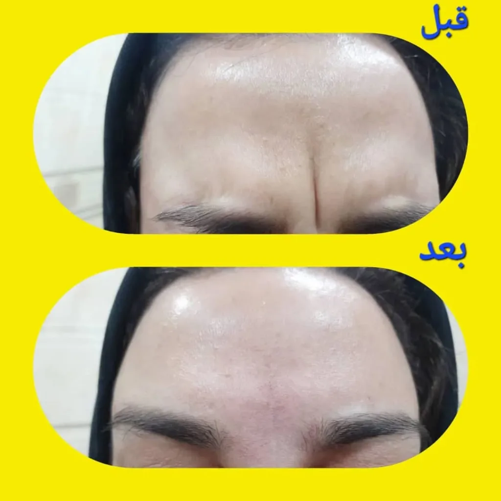 نمونه کار کلینیک زیبایی دکتر مریم عزیززاده سمنان