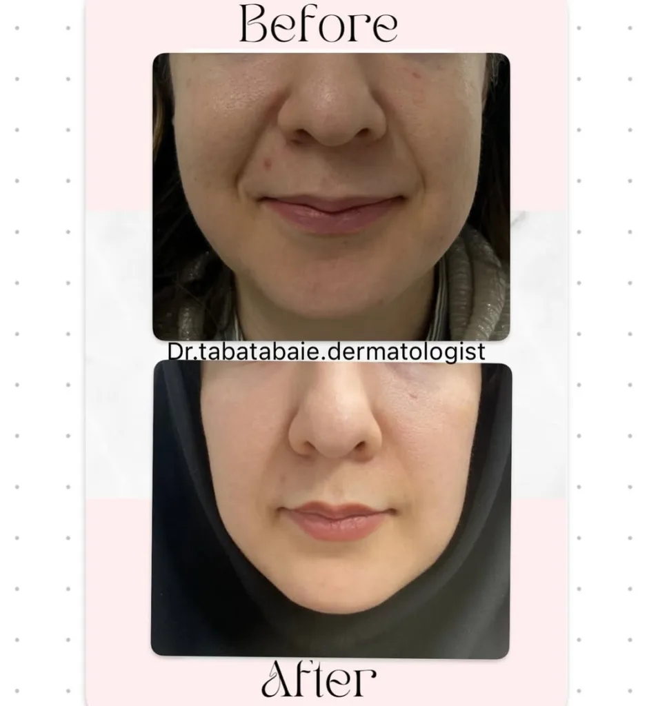 نمونه کار مطب دکتر سید محمدرضا رفیعی طباطبائی بجنورد