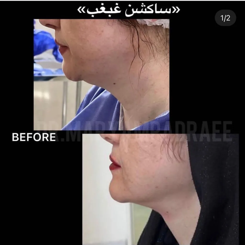 نمونه کار کلینیک زیبایی سلامت ایده آل مشهد