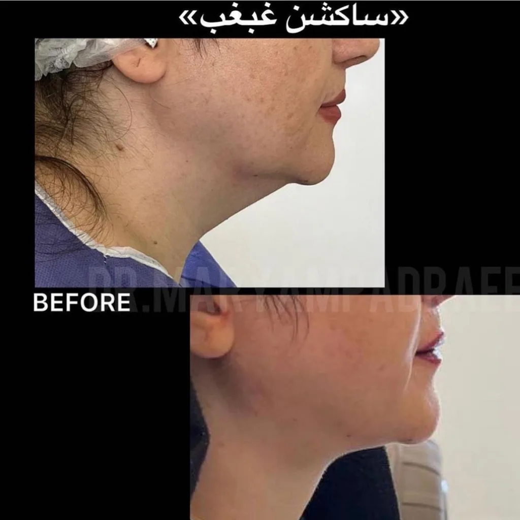 نمونه کار کلینیک زیبایی سلامت ایده آل مشهد