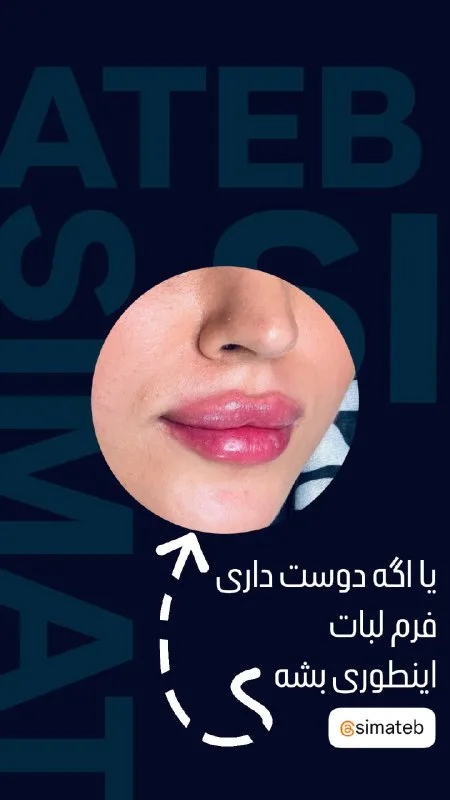 نمونه کار کلینیک زیبایی سیماطب مشهد
