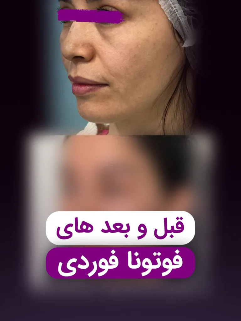 نمونه کار مرکز تخصصی اکسیر جوانی مشهد
