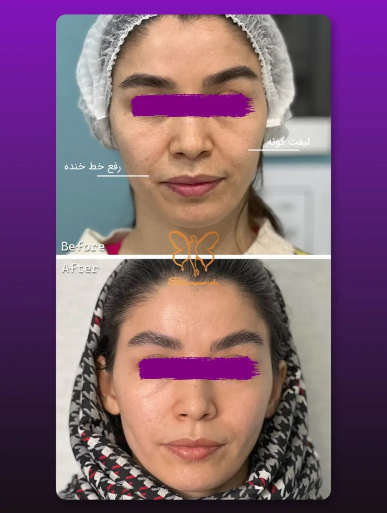 نمونه کار مرکز تخصصی اکسیر جوانی مشهد