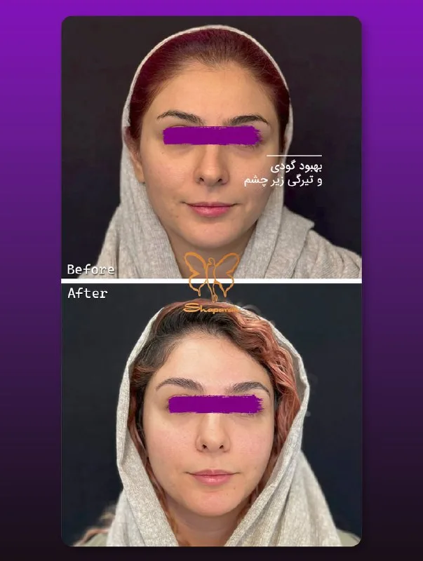 نمونه کار مرکز تخصصی اکسیر جوانی مشهد