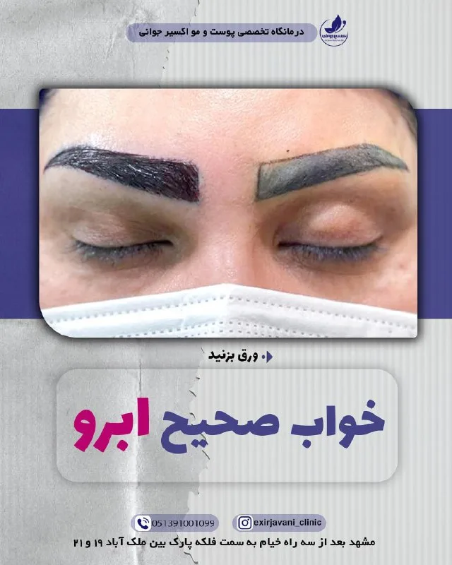 نمونه کار مرکز تخصصی اکسیر جوانی مشهد