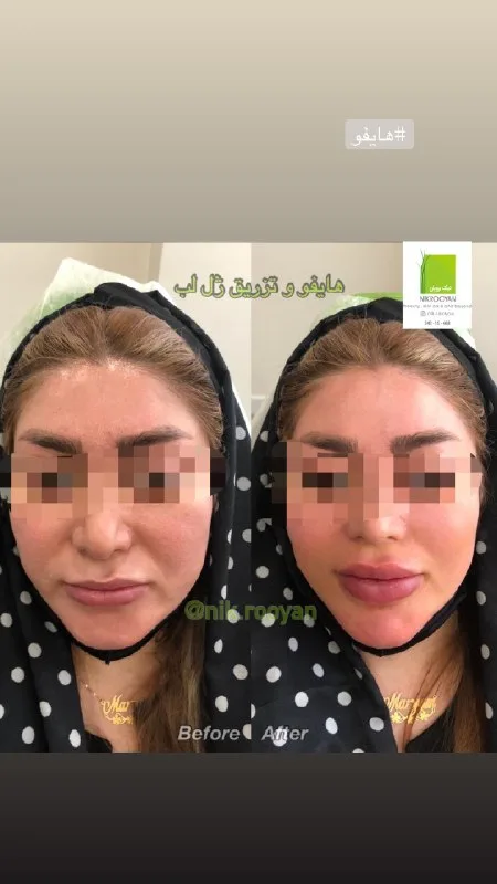نمونه کار کلینیک نیک رویان کرج
