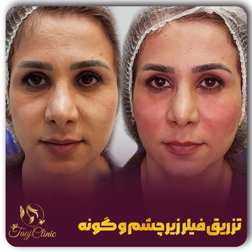 نمونه کار کلینیک تخصصی پوست و زیبایی تاج کرج