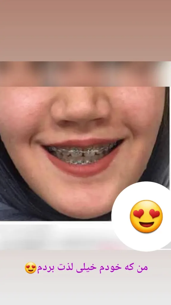 نمونه کار کلینیک زیبایی نیلوفر کرج
