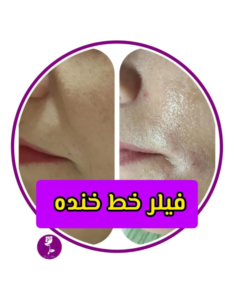 نمونه کار کلینیک زیبایی دکتر زهرا اصلانی اصفهان