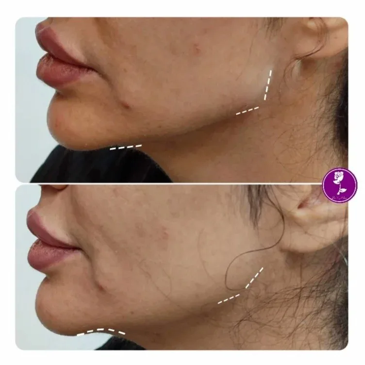 نمونه کار کلینیک زیبایی دکتر زهرا اصلانی اصفهان