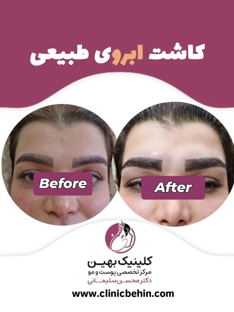 نمونه کار کلینیک زیبایی بهین اصفهان