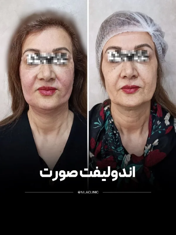 نمونه کار کلینیک زیبایی نیلا اصفهان