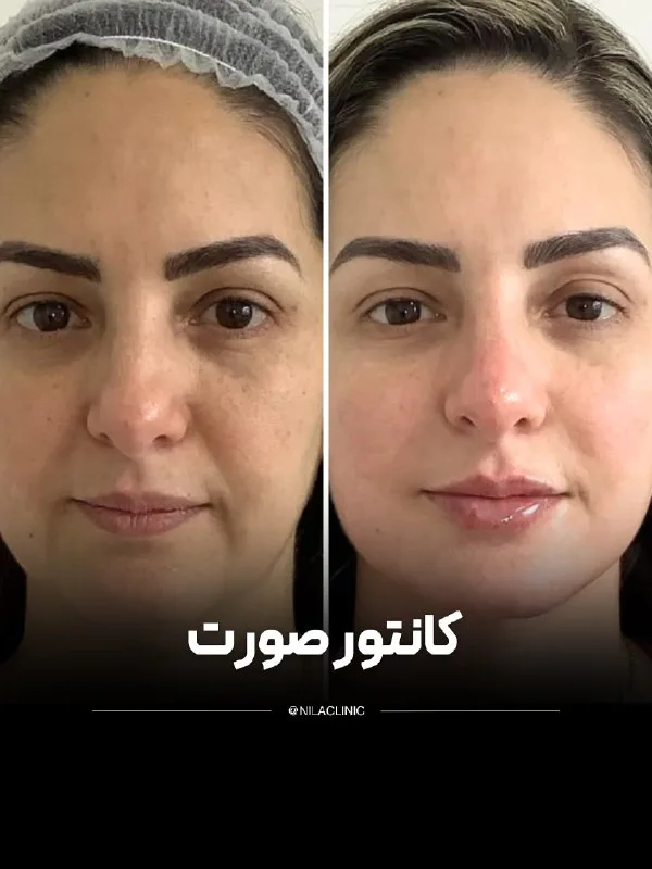نمونه کار کلینیک زیبایی نیلا اصفهان