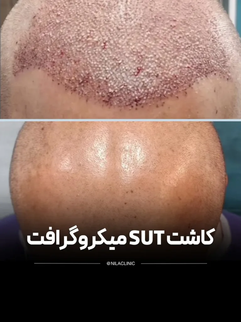 نمونه کار کلینیک زیبایی نیلا اصفهان