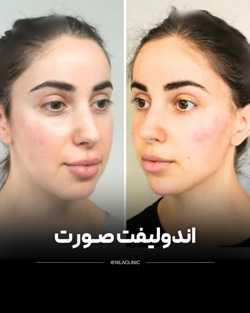 نمونه کار کلینیک زیبایی نیلا اصفهان