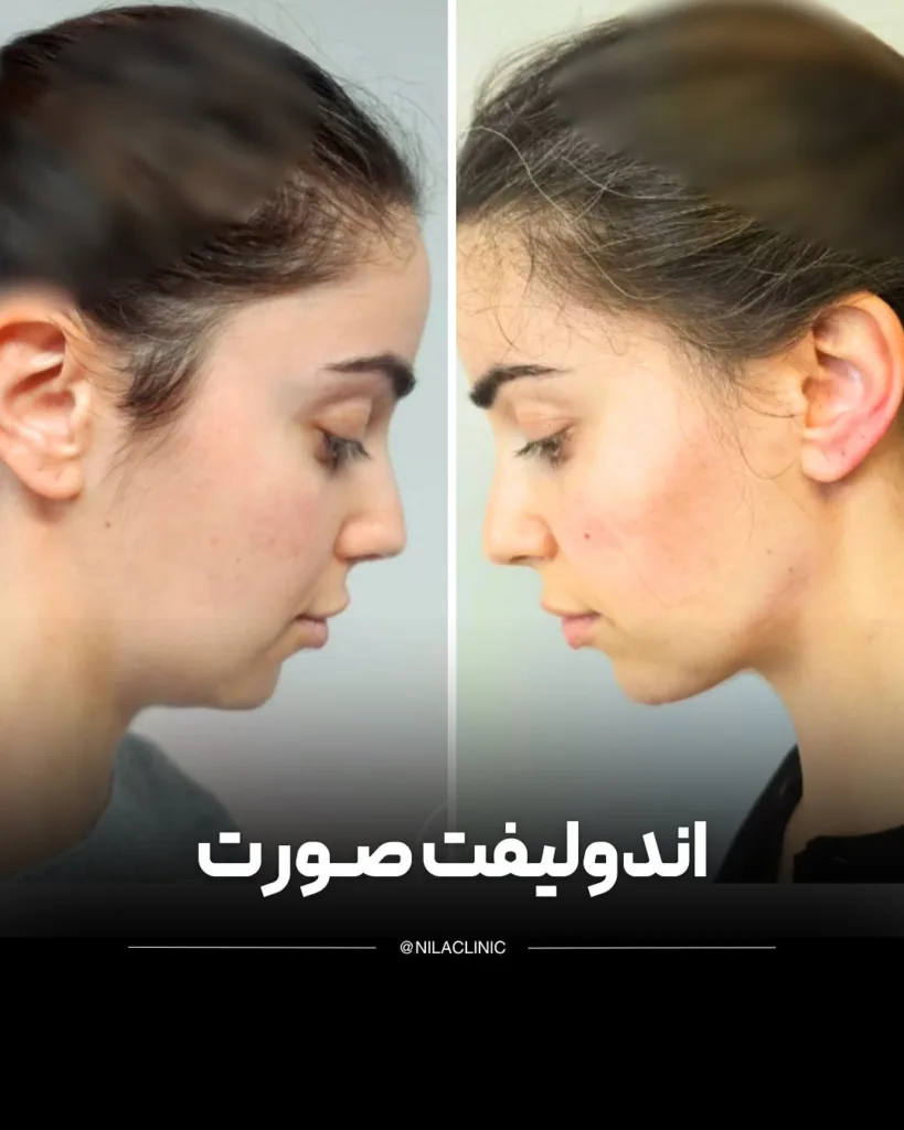 نمونه کار کلینیک زیبایی نیلا اصفهان