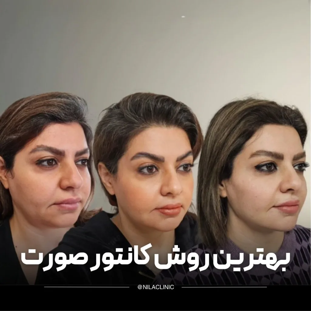 نمونه کار کلینیک زیبایی نیلا اصفهان