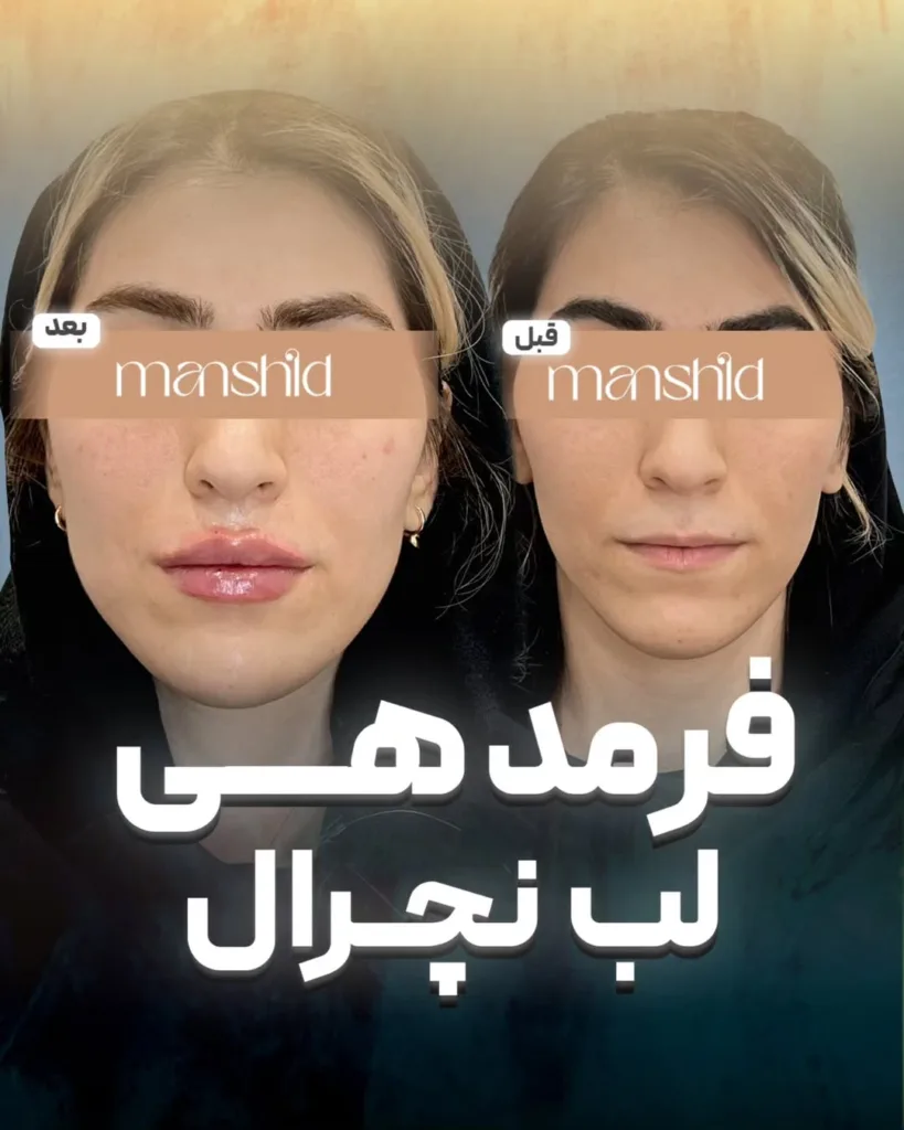 نمونه کار کلینیک زیبایی مان شید اصفهان