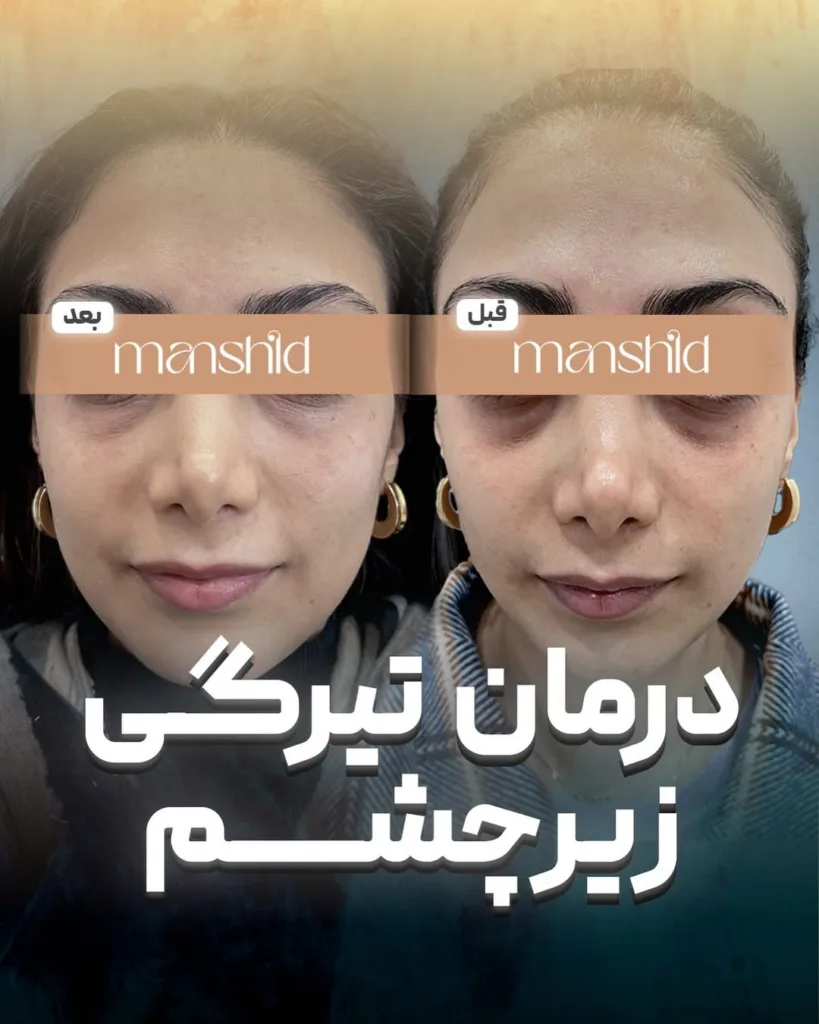 نمونه کار کلینیک زیبایی مان شید اصفهان