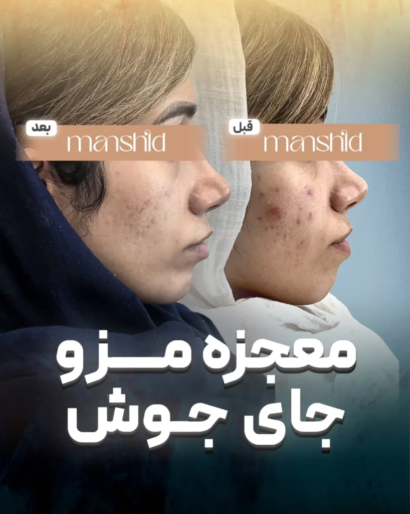 نمونه کار کلینیک زیبایی مان شید اصفهان