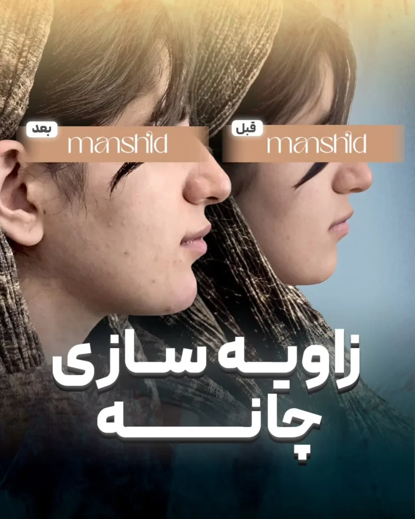 نمونه کار کلینیک زیبایی مان شید اصفهان