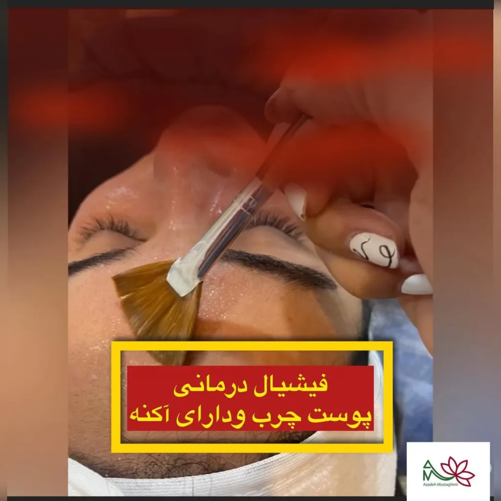 نمونه فیشیال مطب پوست مو ولیزر دکترعلیرضابهرامی کرمان