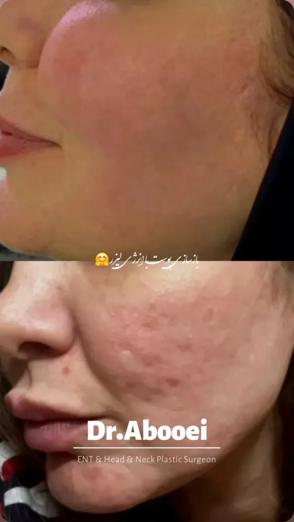 نمونه کار کلینیک زیبایی دکتر ابویی رفسنجان