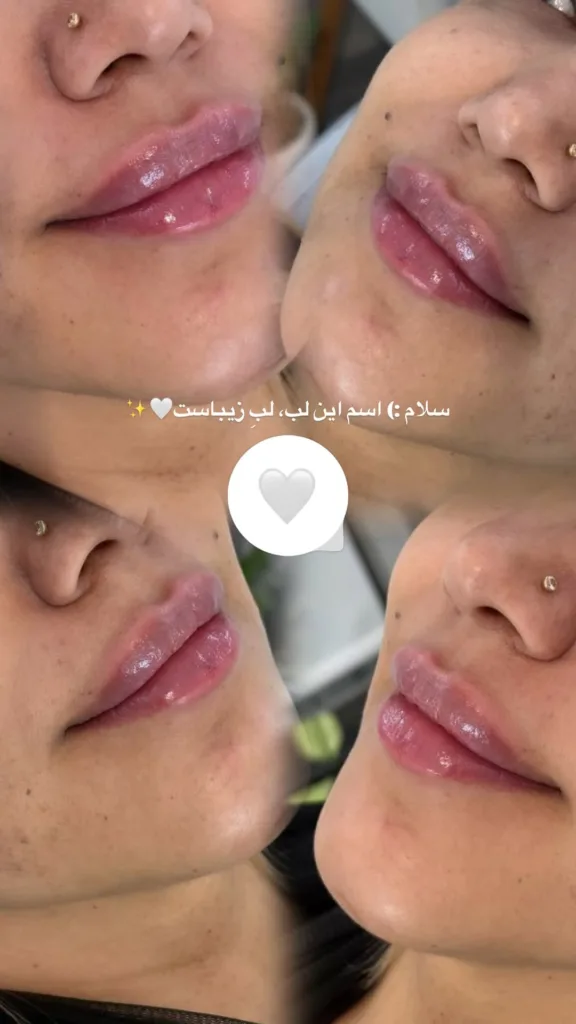 نمونه کار کلینیک زیبایی آیدا شهیدی کرمان