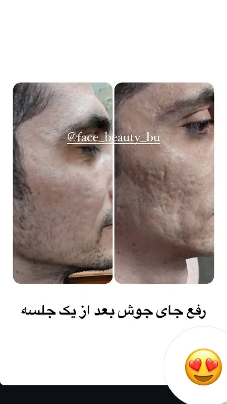 نمونه کار کلینیک زیبایی فیس بیوتی بوشهر
