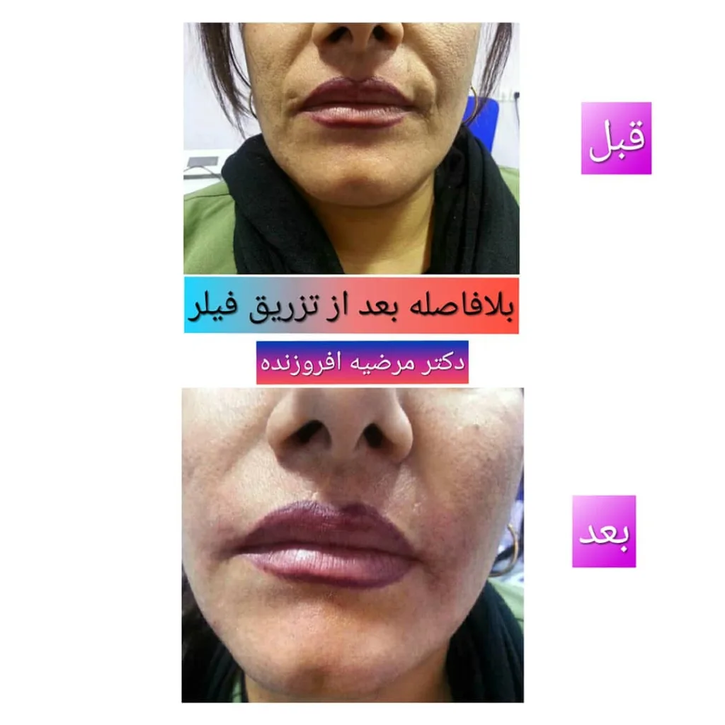 نمونه کار کلینیک زیبایی دکتر مرضیه افروزنده بوشهر
