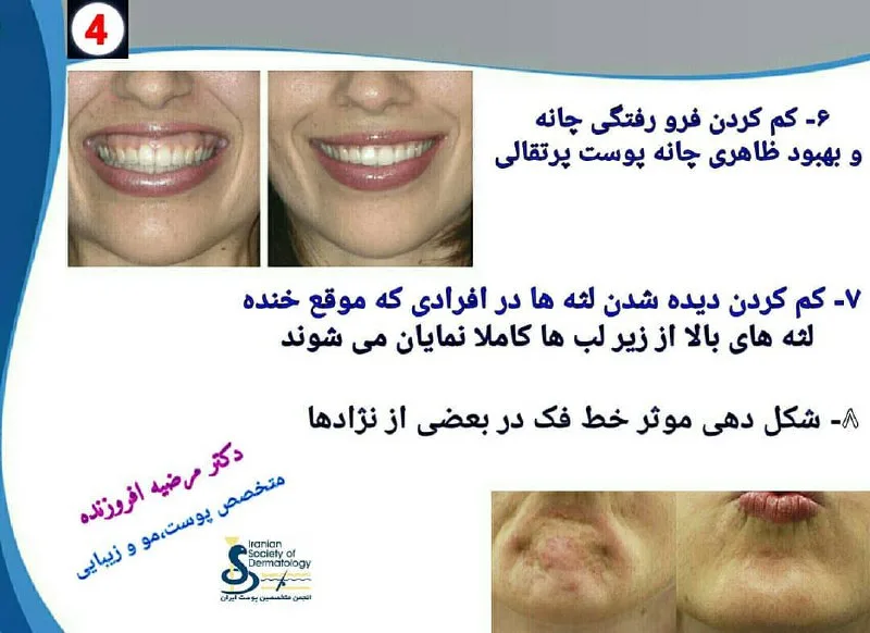 نمونه کار کلینیک زیبایی دکتر مرضیه افروزنده بوشهر
