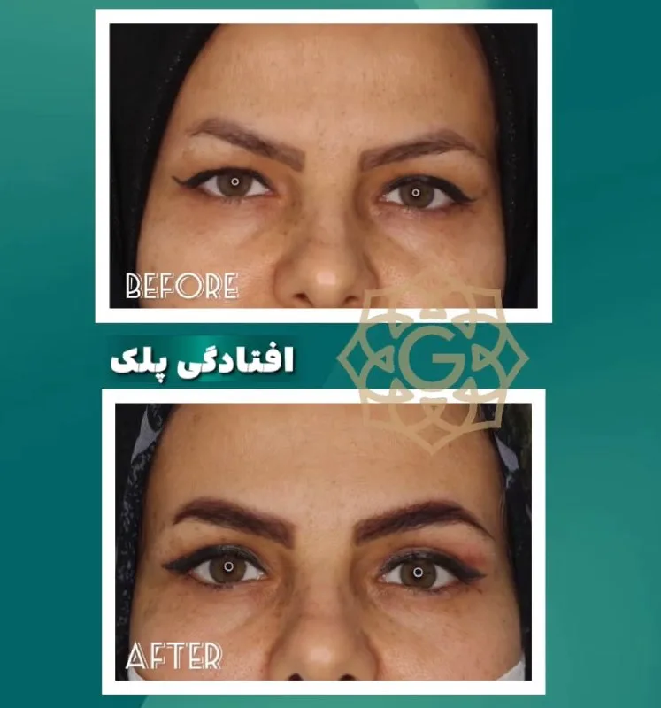 نمونه کار کلینیک زیبایی گلبرگ بوشهر